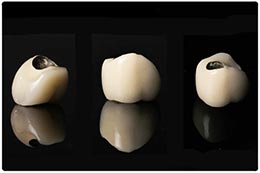 Metal supported porcelain crowns Turkey