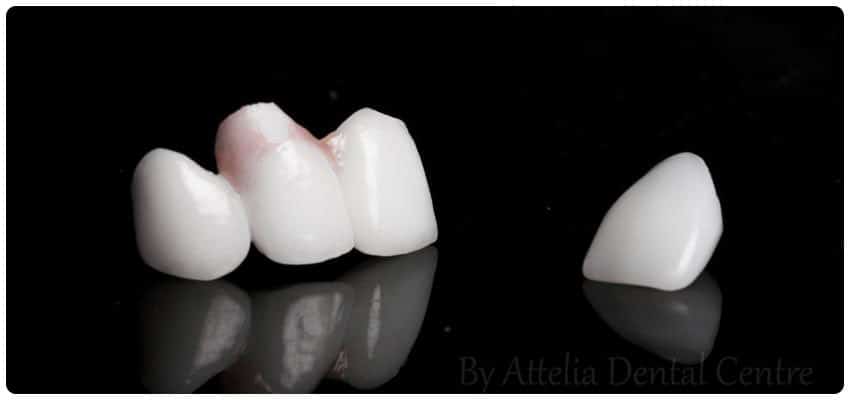 zirconia ceramic crown